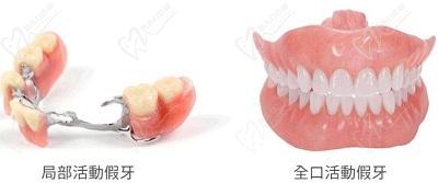 重庆牙博士口腔牙齿修复