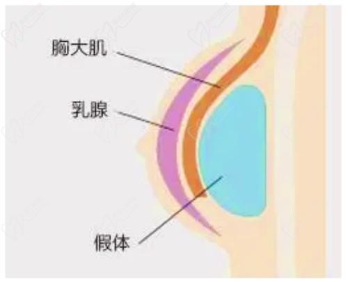 米兰柏羽开启胸部医生面诊日，穆大力、李英大亲诊做出精致自然美胸