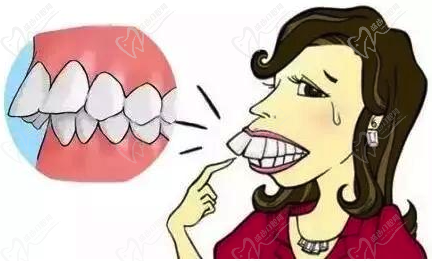 如何简单自测骨性龅牙还是牙性龅牙?联合正畸胡永医生科普